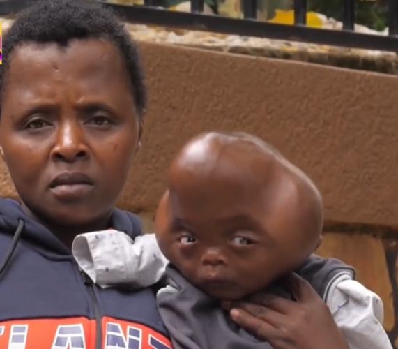 The 15-Year-Old Boy with the Body of an Old Man: 10 People Who Look Like Real-Life Aliens